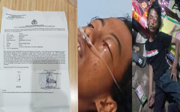 Remaja Tunarungu di Tangerang Tertembak di Mata, Keluarga Desak Polisi Usut Tuntas