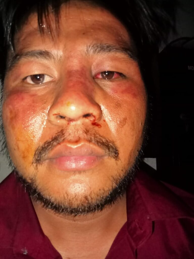 Dianiaya  oleh Preman dan Aparat Kepolisian Saat Demo 138 Korban Akan Ambil Jalur Hukum