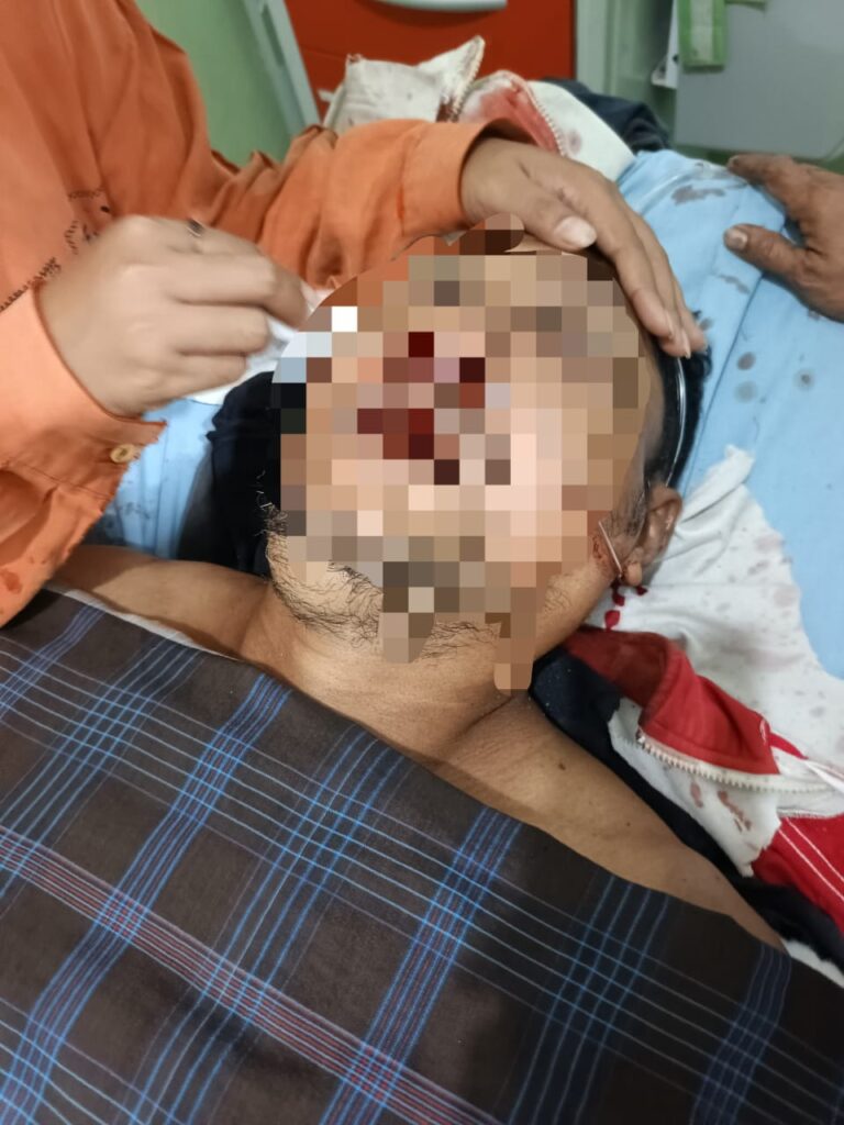 Kasat Lantas Dituding Berbohong, Kejaksaan Balut Tepis Keras Klaim P-21