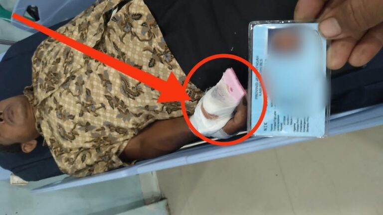 Tangis Istri Buruh di Brebes: Suami Kecelakaan Kerja, Bos Malah Suruh Pakai SKTM dan Intimidasi Keluarga