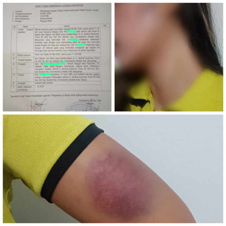 Istri Sah Laporkan Dugaan KDRT, Penganiayaan ke Polresta Banyumas